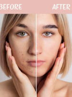 BellaCast BB Cream Result Before & After